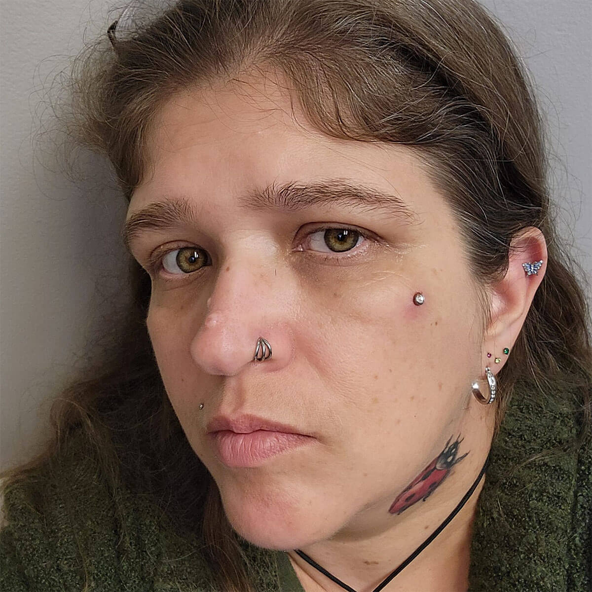 Triple Layered Titanium Cartilage Ring